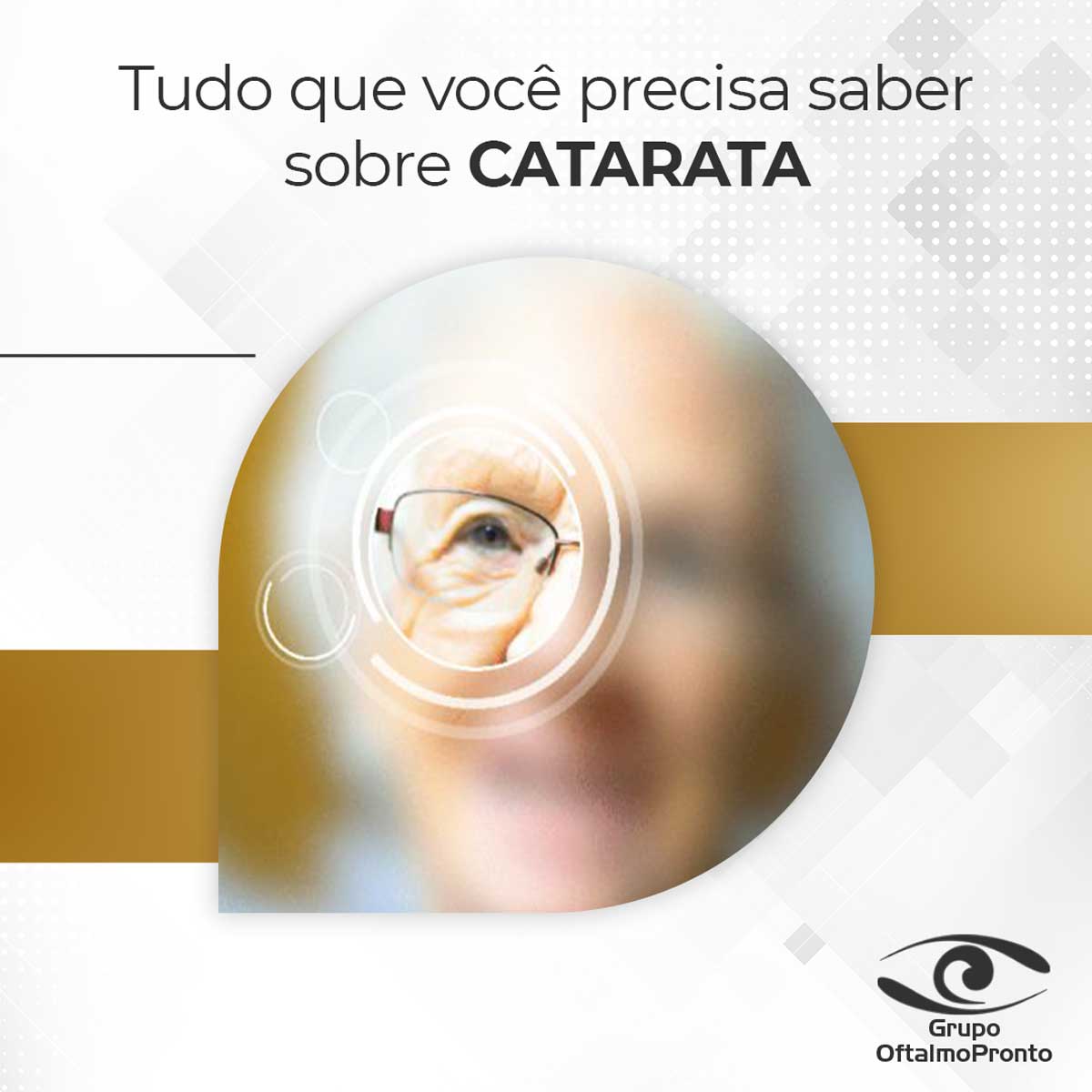 Tudo Que Você Precisa Saber Sobre Catarata Oftalmopronto 